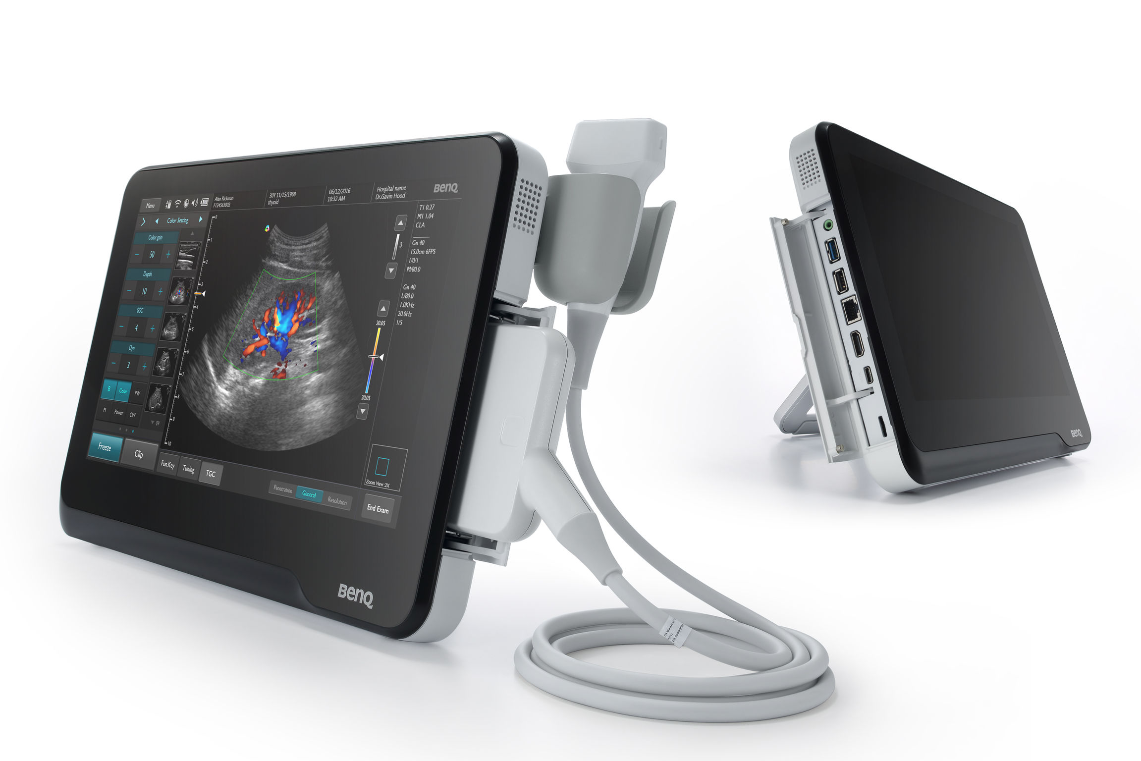 ultrasound BenQ