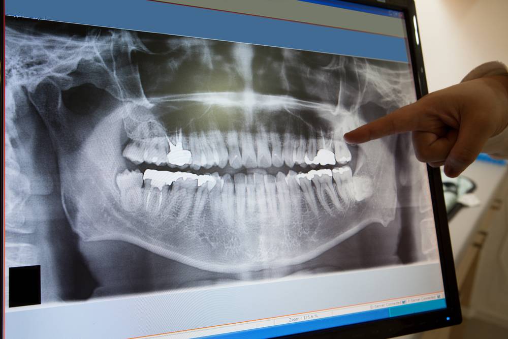Dental